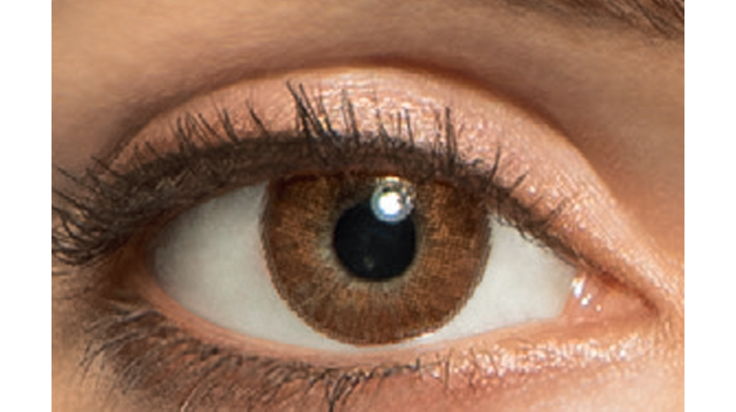 Myopie Lentilles De Contact De Nuit Lentilles Freshlook